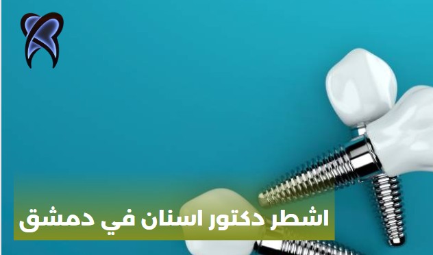 اشطر دكتور اسنان في دمشق