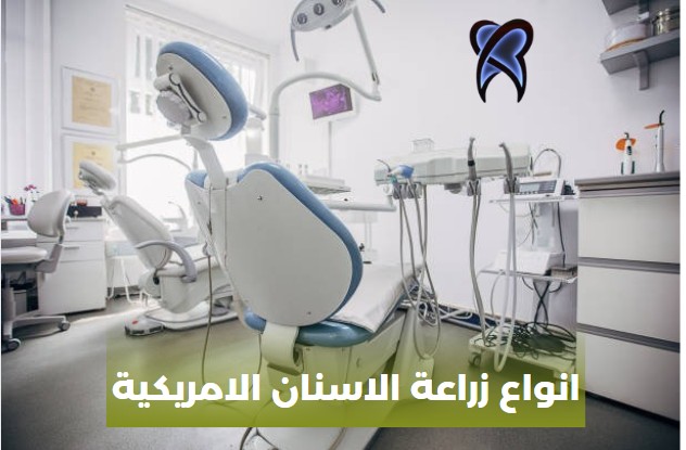 أنواع زرعات الأسنان الألمانية