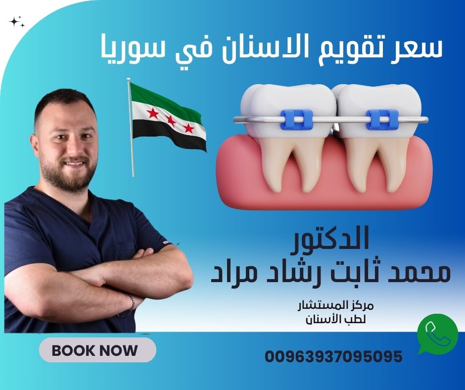 سعر تقويم الاسنان في سوريا