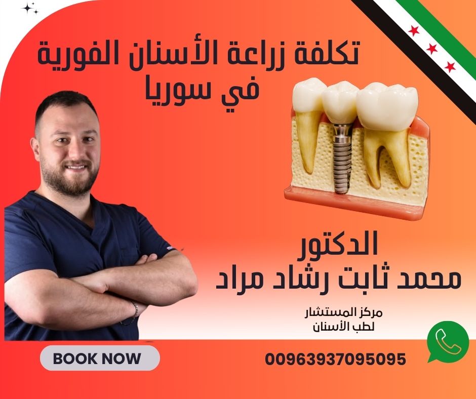 تكلفة زراعة الأسنان الفورية في سوريا