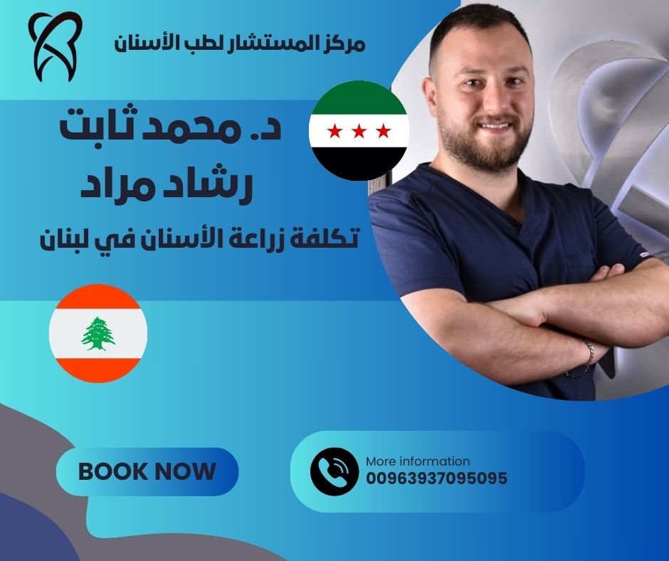تكلفة زراعة الأسنان في لبنان