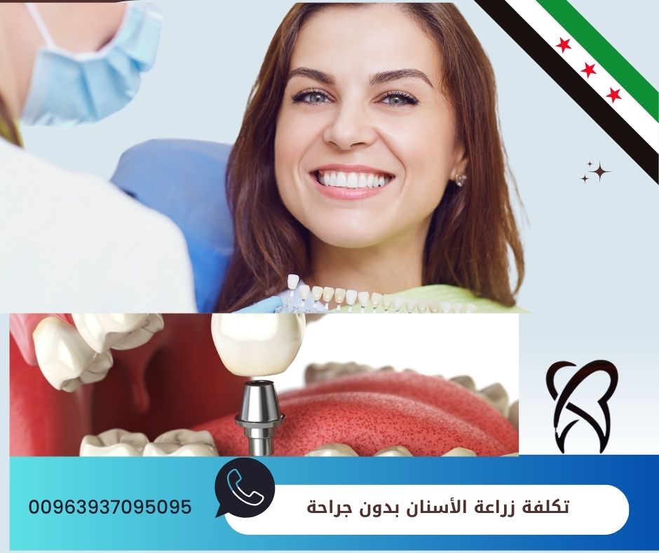 تكلفة زراعة الأسنان بدون جراحة