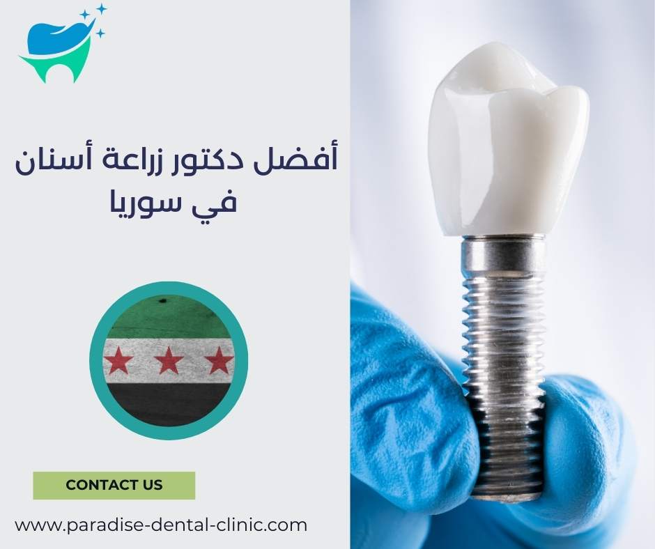 أفضل دكتور زراعة أسنان في سوريا