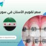 سعر تقويم الأسنان في سوريا