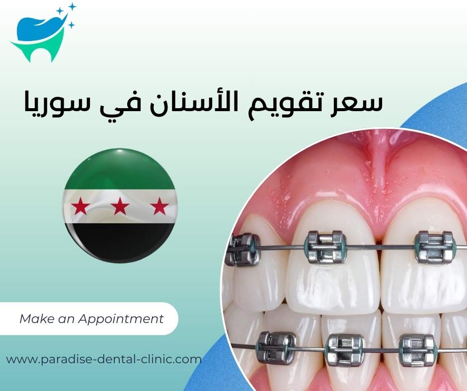 سعر تقويم الأسنان في سوريا