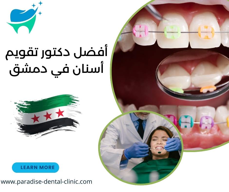 أفضل دكتور تقويم أسنان في دمشق