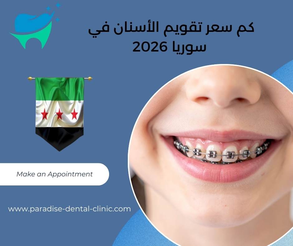 كم سعر تقويم الأسنان في سوريا 2026