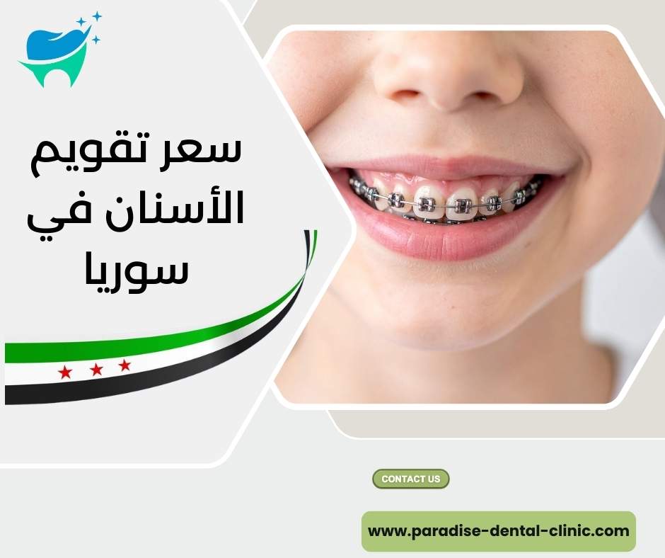 سعر تقويم الأسنان في سوريا