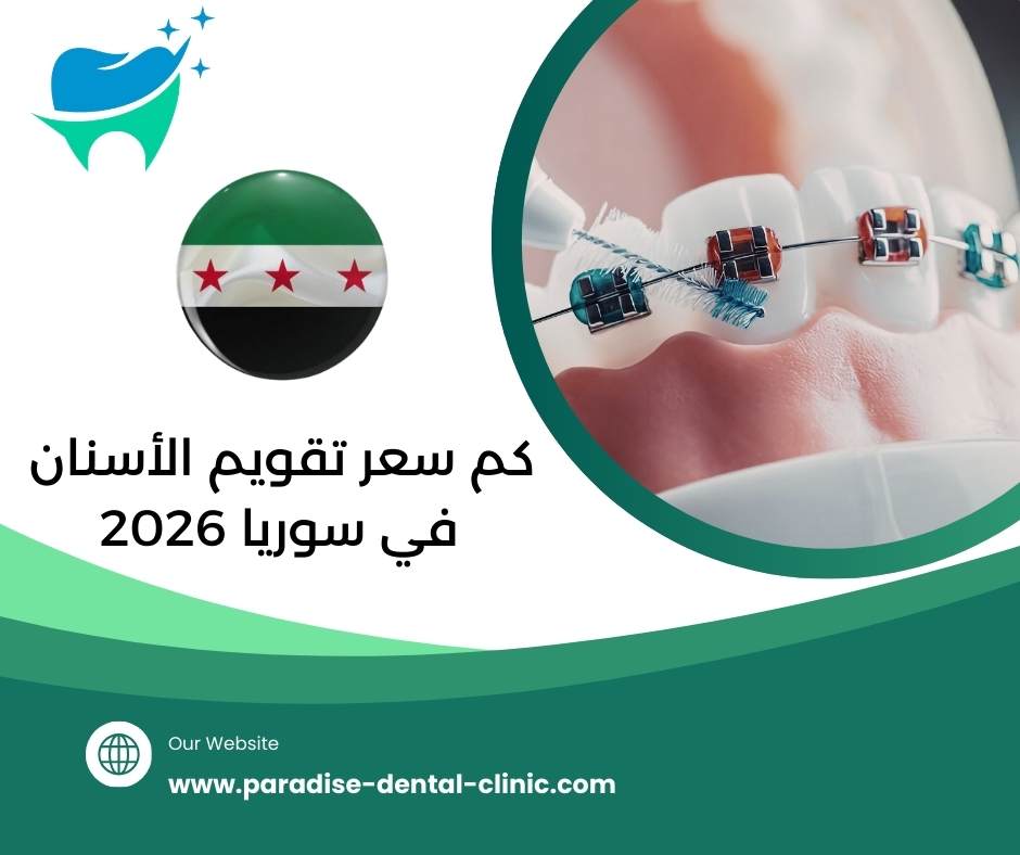 كم سعر تقويم الأسنان في سوريا 2026