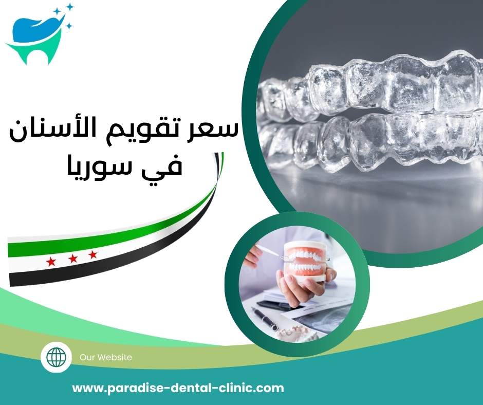 سعر تقويم الأسنان في سوريا