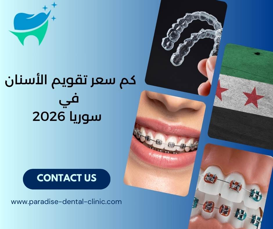 كم سعر تقويم الأسنان في سوريا 2026