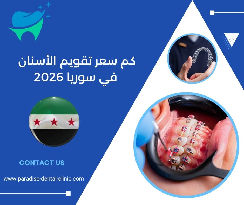كم سعر تقويم الأسنان في سوريا 2026
