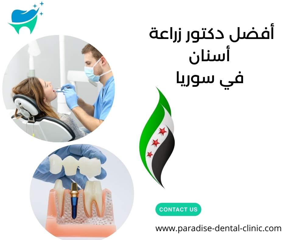 أفضل دكتور زراعة أسنان في سوريا