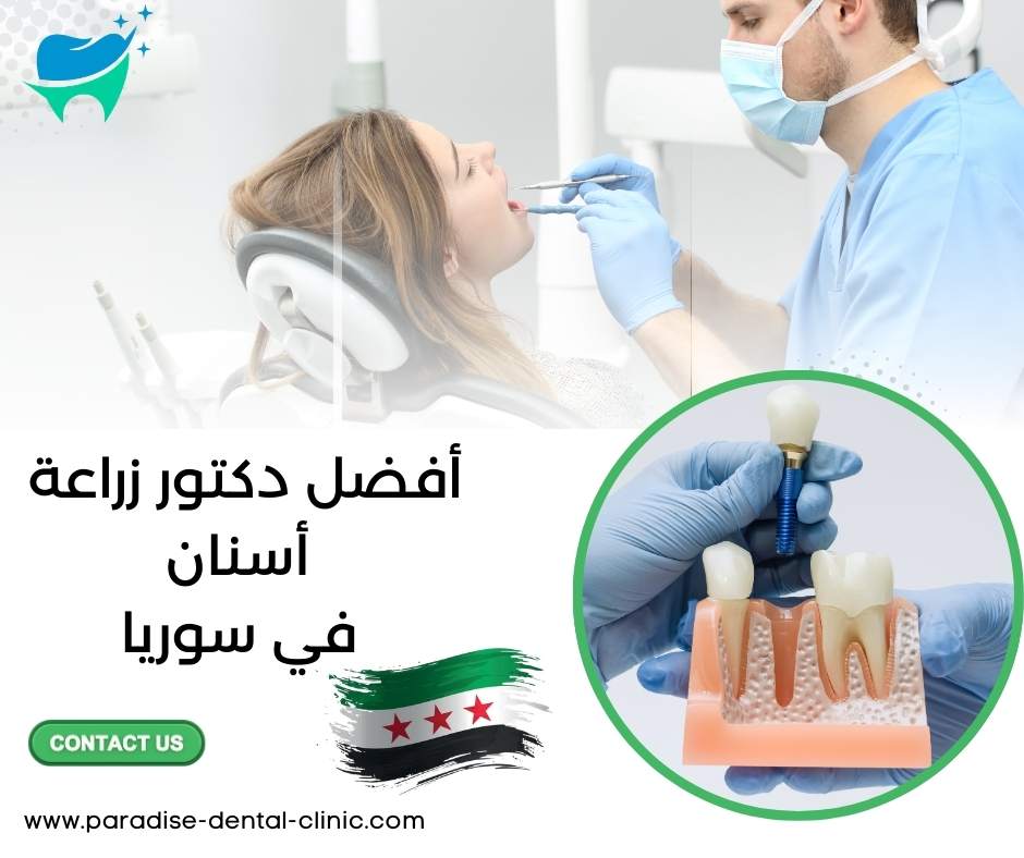 أفضل دكتور زراعة أسنان في سوريا