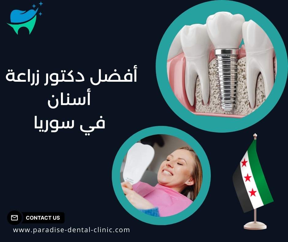 أفضل دكتور زراعة أسنان في سوريا