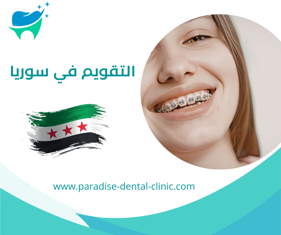 التقويم في سوريا