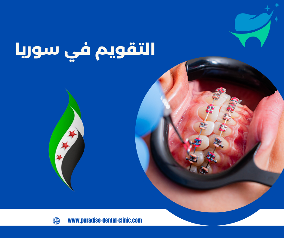 التقويم في سوريا