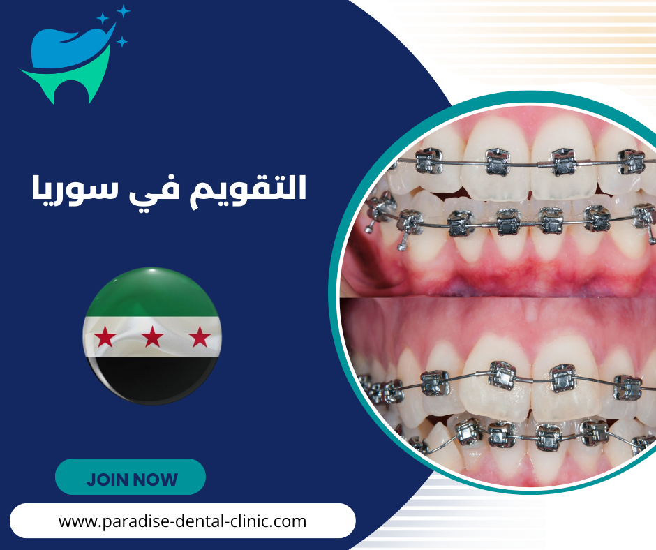 التقويم في سوريا